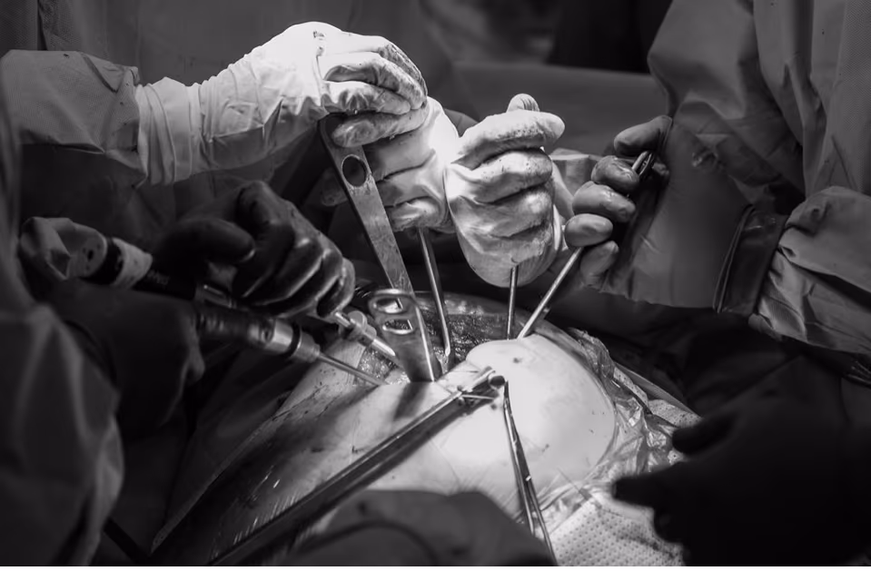 Team performing knee surgery