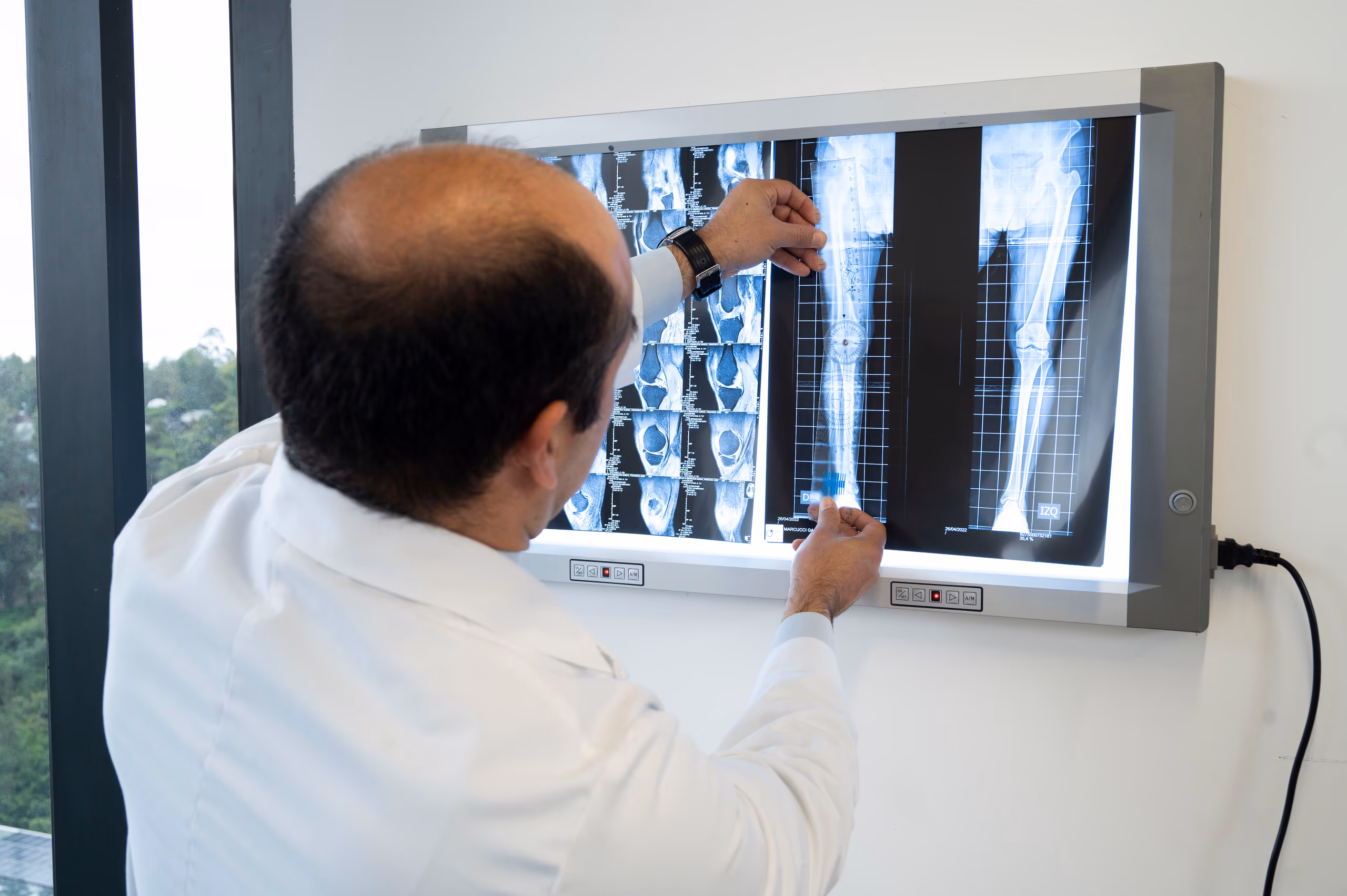 Dr. Rodrigo Ramazzini checking shoulder and knee x-rays